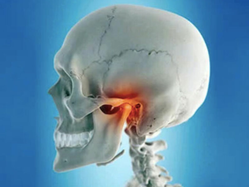 Jing Online Pathology Series: TMJ Pain