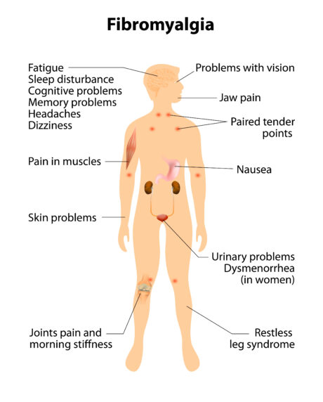 Jing Online Pathology Series: Fibromyalgia and CFS